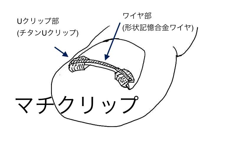 machiclip_schema” ALIGN=